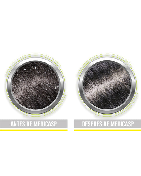 Shampoo Anticaspa 130 ml#color_001-anticaspa
